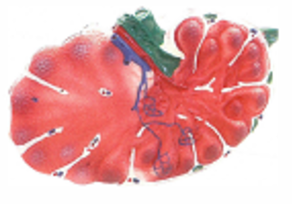 Lymph Node Model